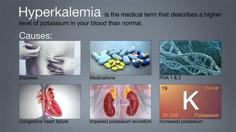 Hyperkalemia Complications