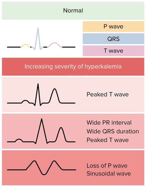 Hyperkalemia Monitoring