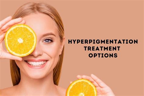 Hyperpigmentation Treatment Options