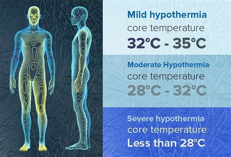 Hypothermia body temperature