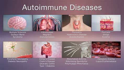 Immunological Disorders