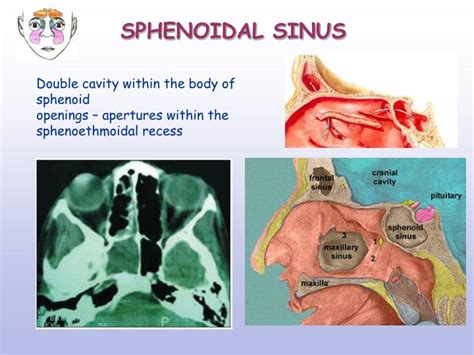 Importance of Sphenoidal Sinuses