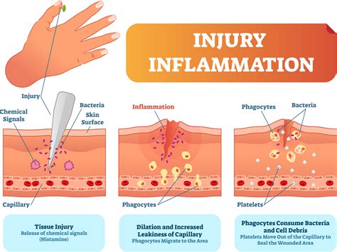 Inflammation