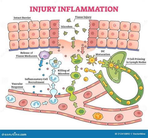 Inflammatory response