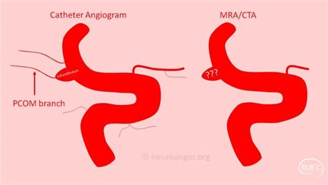 Infundibulum Solutions