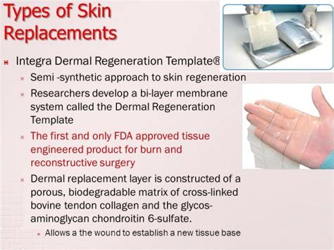 Integra Dermal Regeneration Template