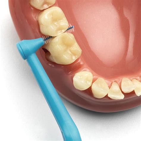 Interdental Brushing