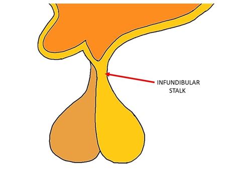 Introduction to Infundibulum