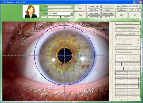 Iridology Chart Software