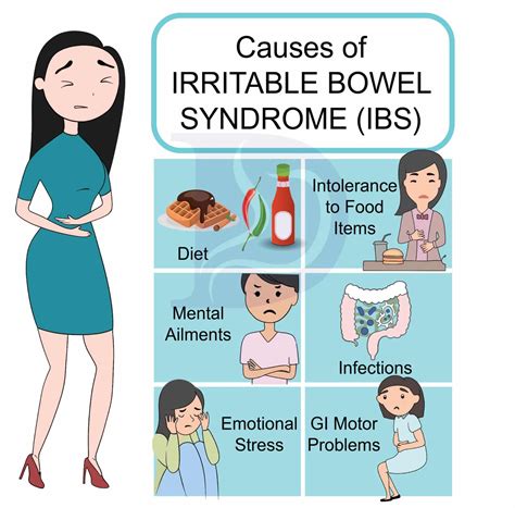 Irritable bowel syndrome symptoms