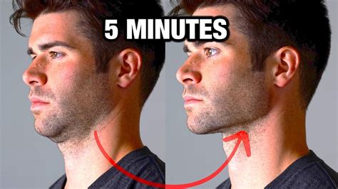 Description of Jaw Exercises