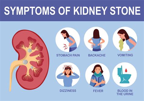 Kidney Stone Symptoms