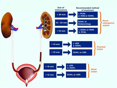 Kidney Stone Treatment