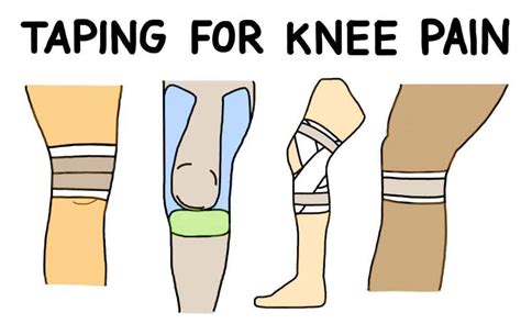 Knee wrapping techniques for injury prevention