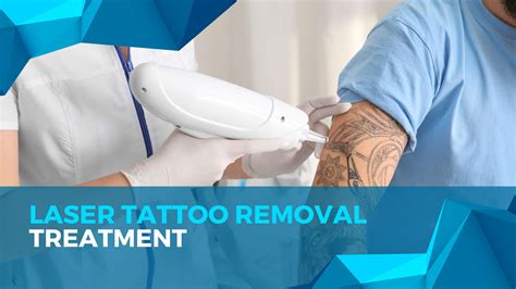 Laser tattoo removal prevention