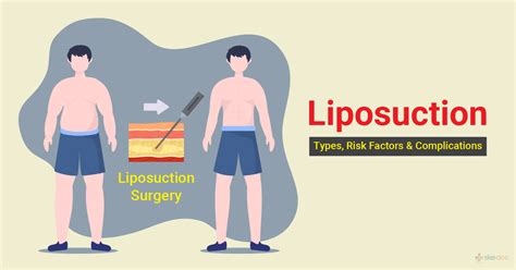 Lipo Waist Risks and Complications