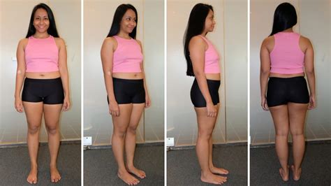 Lipo Waist Tips and Advice