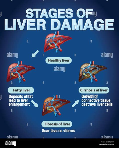 Description of Liver Damage