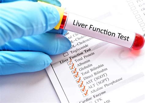 Liver Function Tests