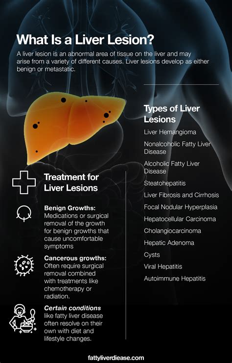 Liver Lesion Image 1