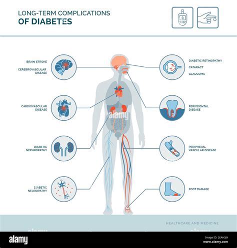 Long-Term Effects and Complications