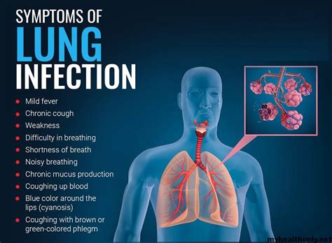 Lung infection and pneumonia