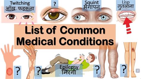 Medical Conditions That Can Disqualify You