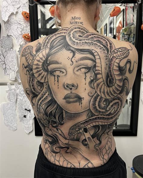 Medusa tattoo removal