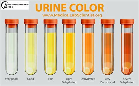 MEPS Physical Exam Urinalysis