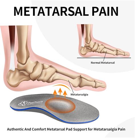 Metatarsalgia pain in the foot