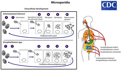 Microsporidia Prevention