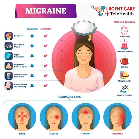 Migraines