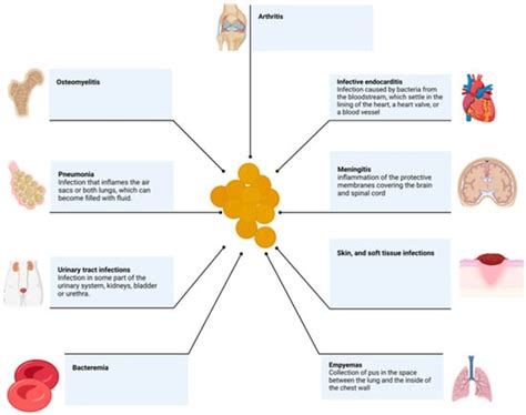 MRSA Meningitis