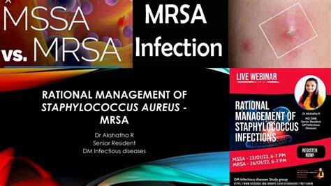 MRSA Treatment Image