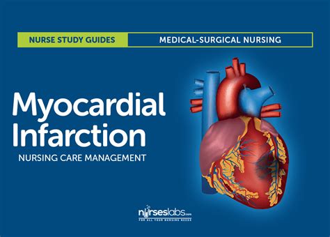 Myocardial Infarction Management