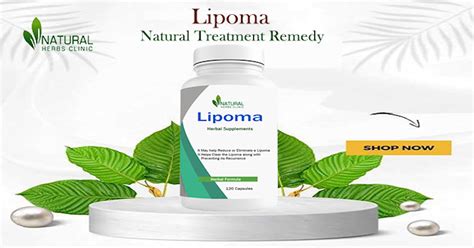 Description of Natural Lipoma Remedies