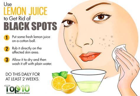 Natural remedies for black dots