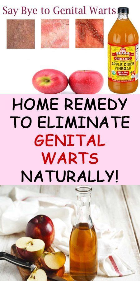 Natural Remedies for Genital Warts