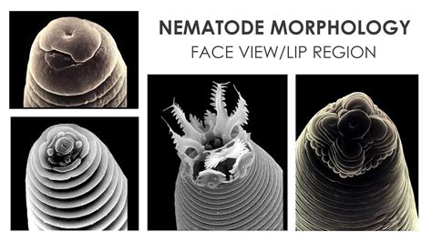 Nematode morphology