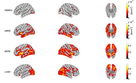 Neuro Mag Comparison