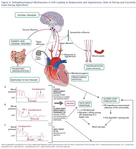 Complications of Neurocardiogenic Syncope