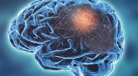 Impact of Neurological Disorders