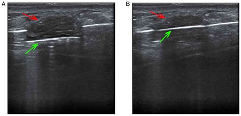 New ultrasound technologies