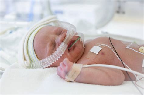 Newborn Oxygen Levels and Support