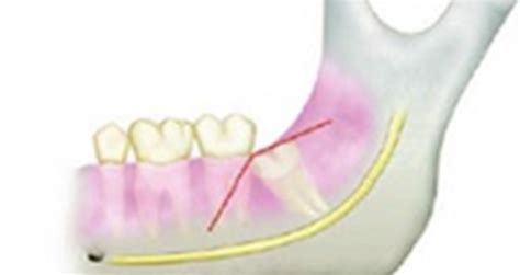 Oral Surgery Image 2