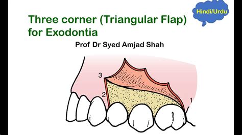 Oral Surgery Image 3