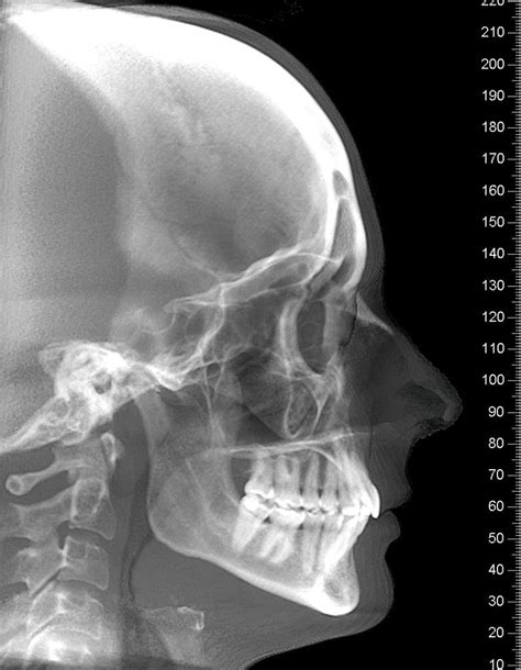 Orthodontist x-ray