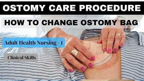 Ostomy Care Nursing Skills