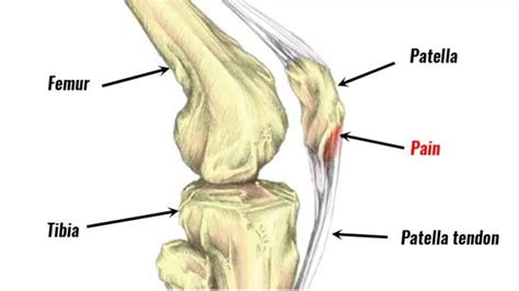 Patellar Tendon