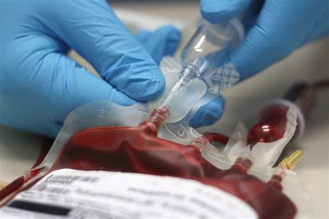 Patient safety during transfusion